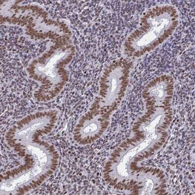 Immunohistochemistry-Paraffin: CTCF Antibody (CL0304) [NBP2-52909]