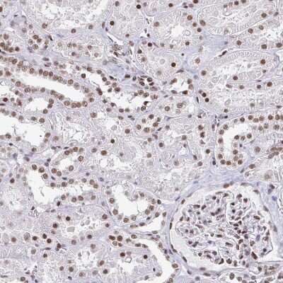 Immunohistochemistry-Paraffin: CTCF Antibody (CL0304) [NBP2-52909]