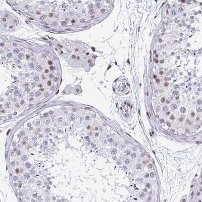Immunohistochemistry-Paraffin: CTCF Antibody (CL0304) [NBP2-52909]