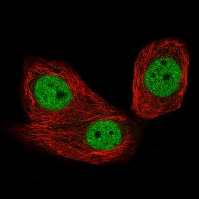 Immunocytochemistry/ Immunofluorescence: CTCF Antibody (CL0305) [NBP2-52910]