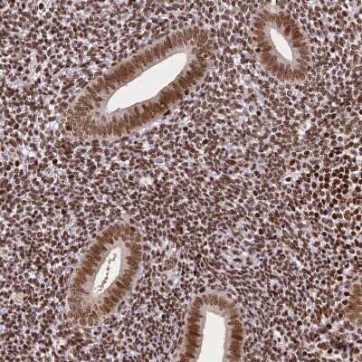 Immunohistochemistry-Paraffin: CTCF Antibody (CL0305) [NBP2-52910]
