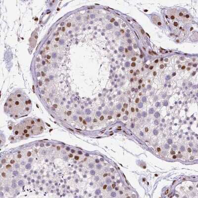 Immunohistochemistry-Paraffin: CTCF Antibody (CL0305) [NBP2-52910]