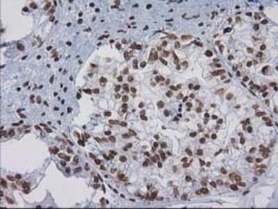 Immunohistochemistry: CTDSP1 Antibody (OTI1B6) - Azide and BSA Free [NBP2-72110]