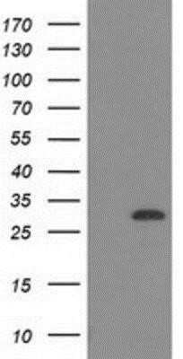 Western Blot: CTDSP1 Antibody (OTI1B6)Azide and BSA Free [NBP2-72110]