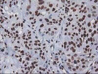 Immunohistochemistry-Paraffin: CTDSP1 Antibody (OTI1B6) [NBP2-03456]