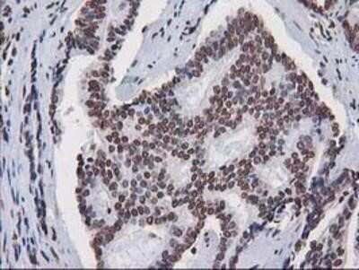 Immunohistochemistry-Paraffin: CTDSP1 Antibody (OTI1B6) [NBP2-03456]