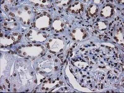 Immunohistochemistry-Paraffin: CTDSP1 Antibody (OTI1B6) [NBP2-03456]