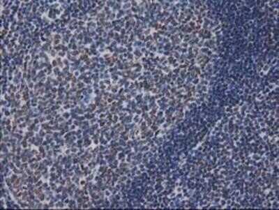 Immunohistochemistry-Paraffin: CTDSP1 Antibody (OTI1B6) [NBP2-03456]