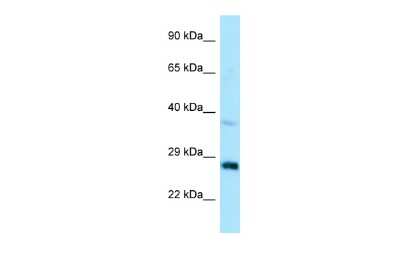 Western Blot: CTDSP1 Antibody [NBP2-87226]