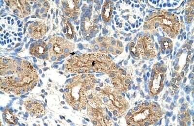Immunohistochemistry-Paraffin: CTDSPL Antibody [NBP1-53169]