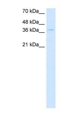 Western Blot: CTDSPL Antibody [NBP1-53169]