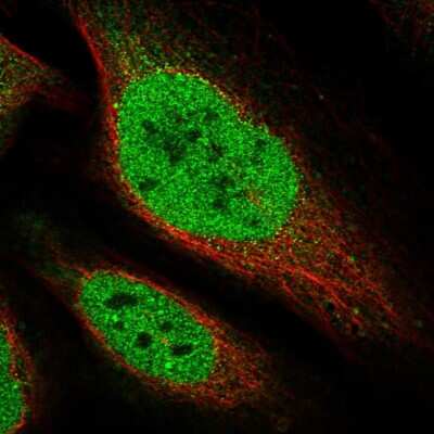 Immunocytochemistry/ Immunofluorescence: CTDSPL2 Antibody [NBP1-91814]