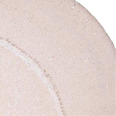 Immunohistochemistry-Paraffin: CTGF/CCN2 Antibody (CL5339) [NBP2-61415]