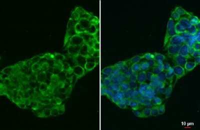 Immunocytochemistry/ Immunofluorescence: CTGF/CCN2 Antibody (28711) [NBP3-13686]