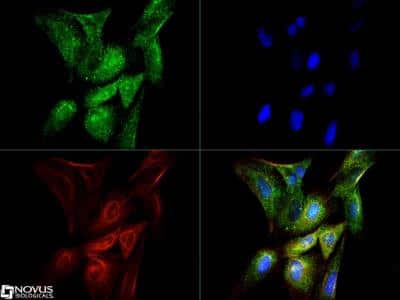 Immunocytochemistry/ Immunofluorescence: CTGF/CCN2 Antibody [NB100-724]