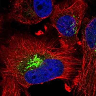 Immunocytochemistry/ Immunofluorescence: CTGF/CCN2 Antibody [NBP1-86571]