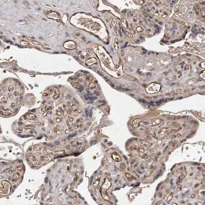 Immunohistochemistry-Paraffin: CTGF/CCN2 Antibody [NBP1-86571]