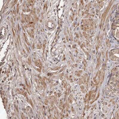 Immunohistochemistry-Paraffin: CTGF/CCN2 Antibody [NBP1-86571]