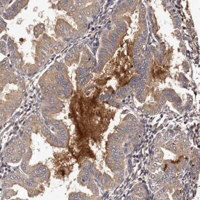 Immunohistochemistry-Paraffin: CTGF/CCN2 Antibody [NBP1-86571]