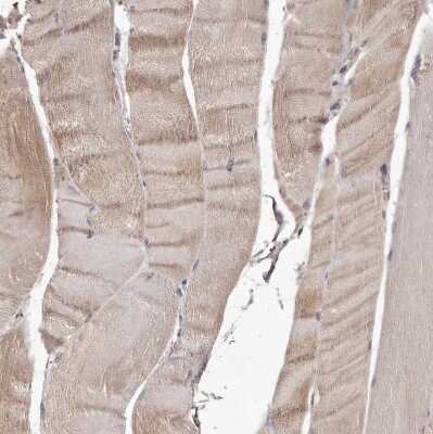 Immunohistochemistry-Paraffin: CTGF/CCN2 Antibody [NBP1-86571]