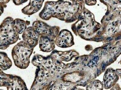 Immunohistochemistry-Paraffin: CTGF/CCN2 Antibody (MM0038-6B13) - Azide and BSA Free [NB110-61004]