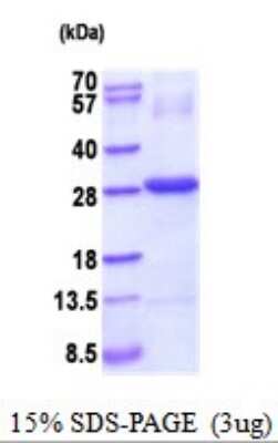 SDS-PAGE: Recombinant Human CTHRC1 His Protein [NBP2-52008]