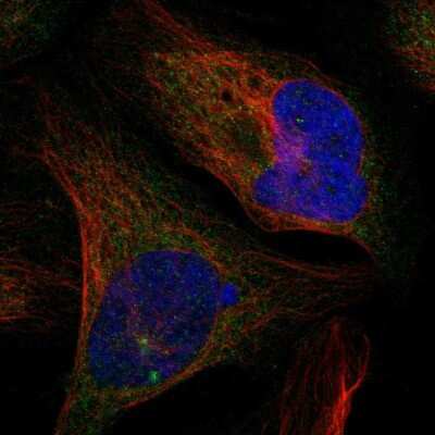 Immunocytochemistry/ Immunofluorescence: CTIF Antibody [NBP1-83007]