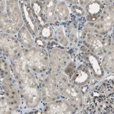 Immunohistochemistry-Paraffin: CTIF Antibody [NBP1-83007]