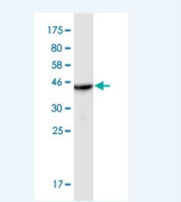 Western Blot: CTL1/SLC44A1 Antibody (4E12) [H00023446-M04]