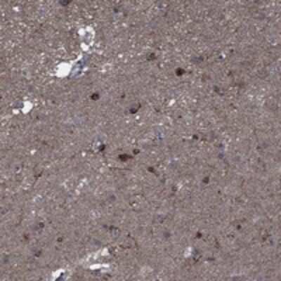 Immunohistochemistry-Paraffin: CTL1/SLC44A1 Antibody [NBP3-17824]