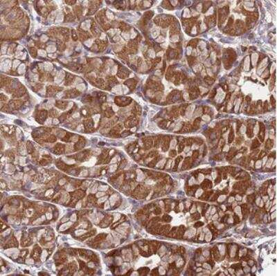 Immunohistochemistry: CTL5 Antibody [NBP2-30814]