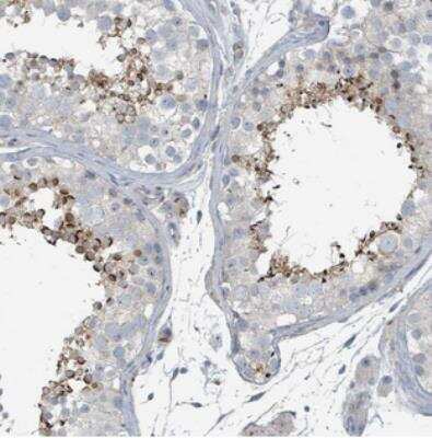 Immunohistochemistry-Paraffin: CTL5 Antibody [NBP2-30869]