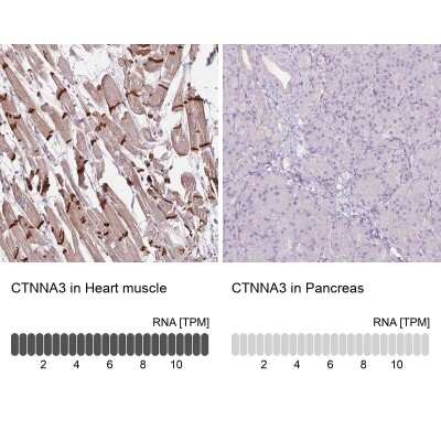 Immunohistochemistry-Paraffin: CTNNA3 Antibody [NBP2-49348]