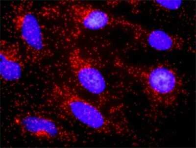 Proximity Ligation Assay: CTNNA3 Antibody [H00029119-D01P]