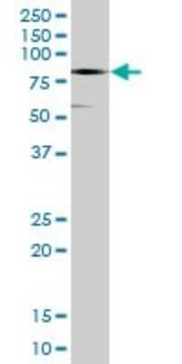 Western Blot: CTNNA3 Antibody [H00029119-B01P]
