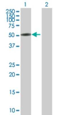 Western Blot: CTNNA3 Antibody [H00029119-B01P]
