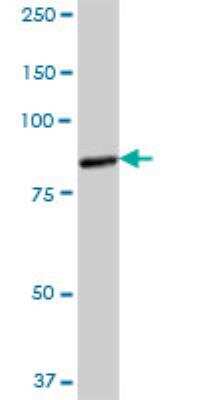 Western Blot: CTNNAL1 Antibody [H00008727-B01P]