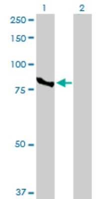 Western Blot: CTNNAL1 Antibody [H00008727-D01P]