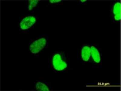 Immunocytochemistry/ Immunofluorescence: CTNNBL1 Antibody (5F1) [H00056259-M01]