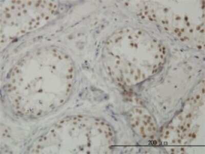 Immunohistochemistry-Paraffin: CTNNBL1 Antibody (5F1) [H00056259-M01]