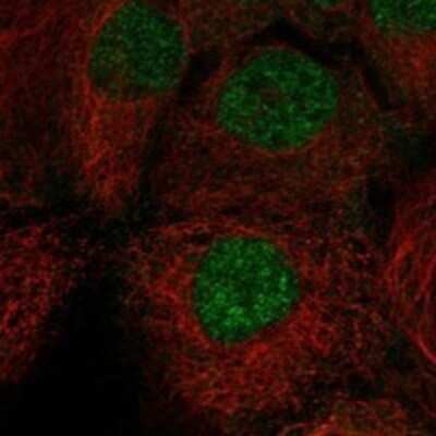 Immunocytochemistry/ Immunofluorescence: CTNNBL1 Antibody [NBP3-17825]