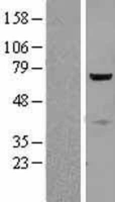 Western Blot: CTNNBL1 Overexpression Lysate [NBL1-09578]