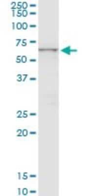 Western Blot: CTNS Antibody (5G6) [H00001497-M09]