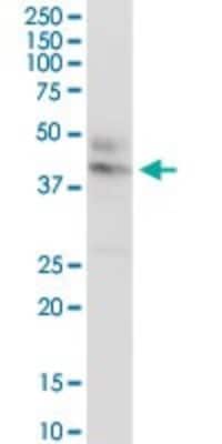Western Blot: CTNS Antibody [H00001497-D01P]