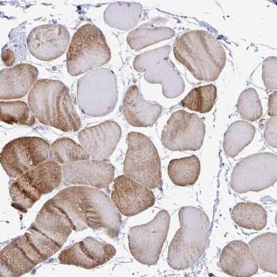 Immunohistochemistry-Paraffin: CTP synthase Antibody [NBP2-57099]