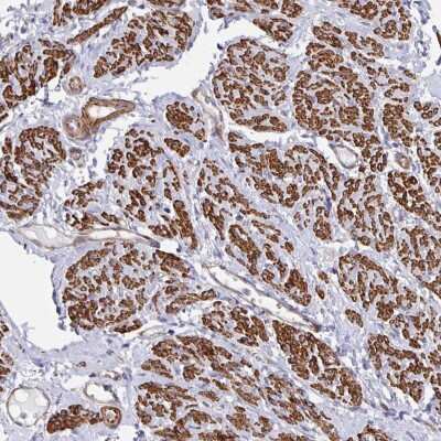 Immunohistochemistry-Paraffin: CTP synthase Antibody [NBP2-57099]