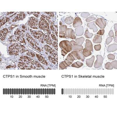 Immunohistochemistry-Paraffin: CTP synthase Antibody [NBP2-57099]