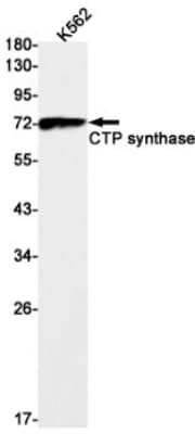 Western Blot: CTP synthase Antibody (S01-9E5) [NBP3-19612]