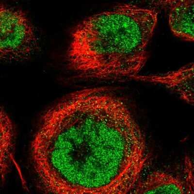 Immunocytochemistry/ Immunofluorescence: CTPS2 Antibody [NBP1-86055]