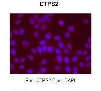 Immunohistochemistry: CTPS2 Antibody [NBP2-84731]
